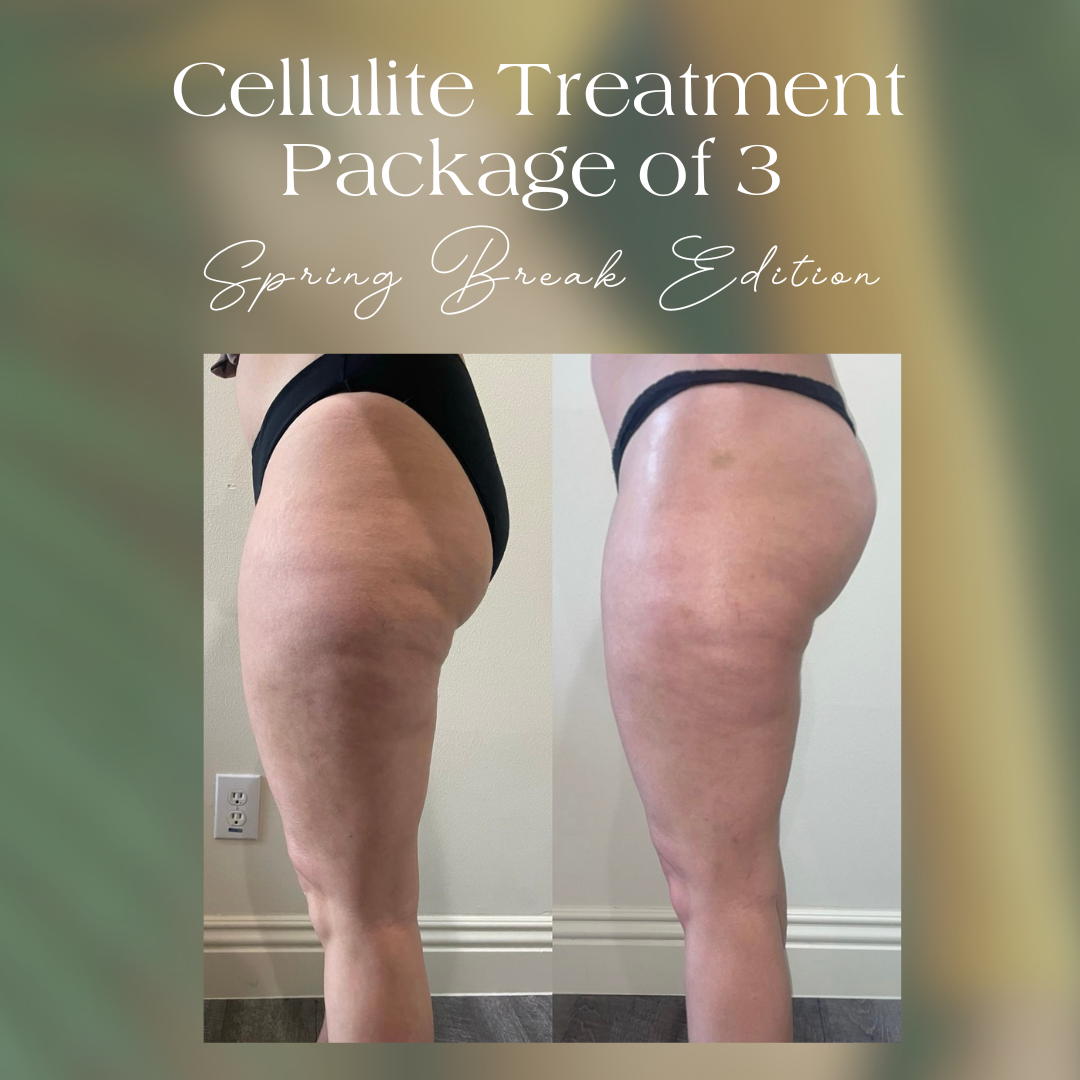 Cellulite Package - 3 Sessions