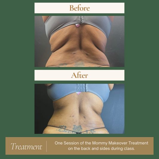 (French) International Body Sculpting Course
