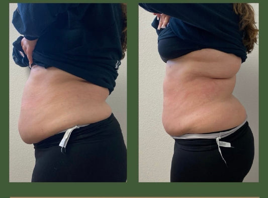 International Body Sculpting Course