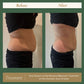 Mommy Makeover - 3 Sessions