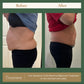 Mommy Makeover - 3 Sessions
