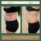 Mommy Makeover - 3 Sessions